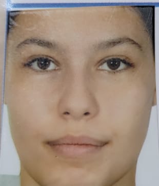 GOLLU Akya