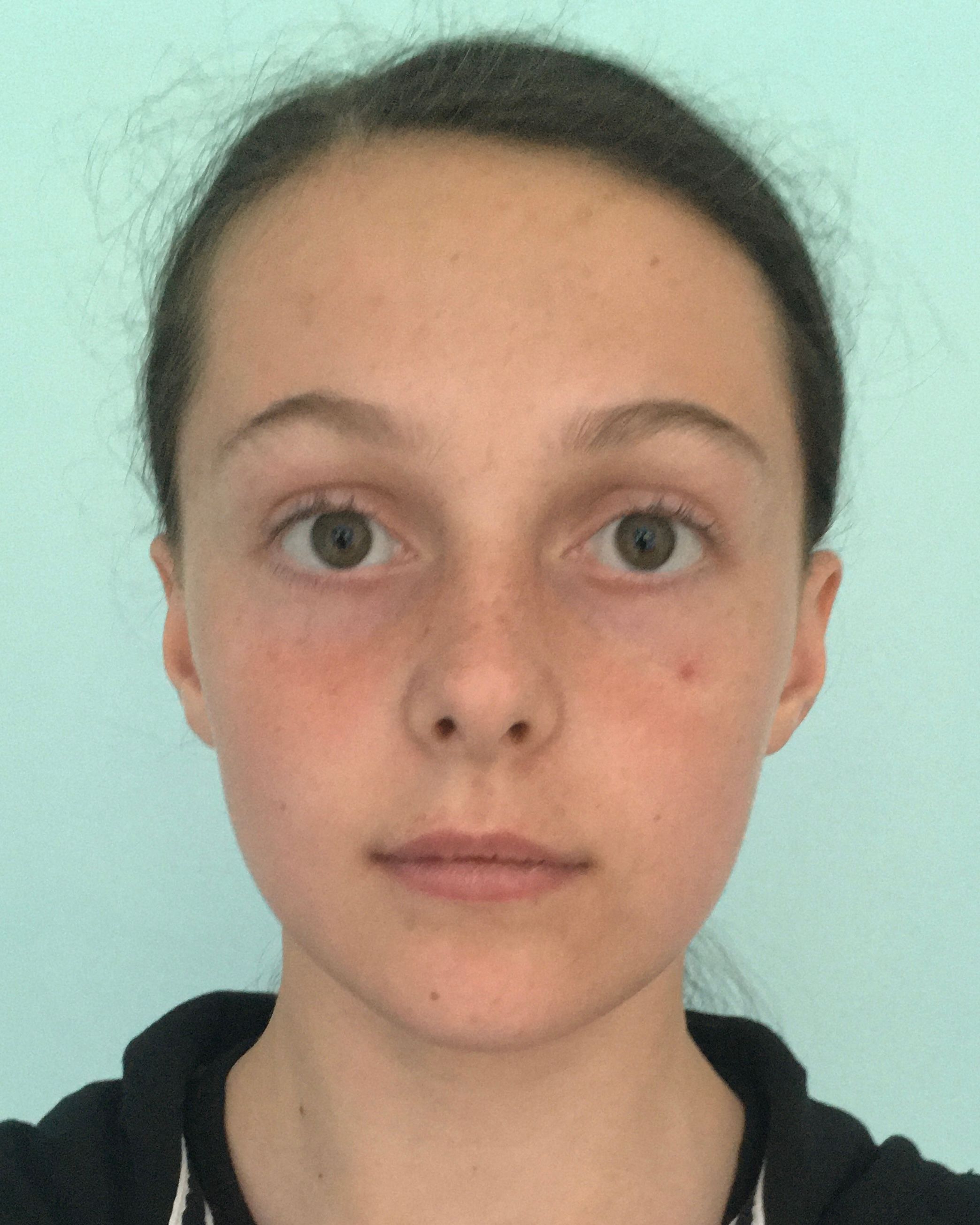 HODKINSON Erika