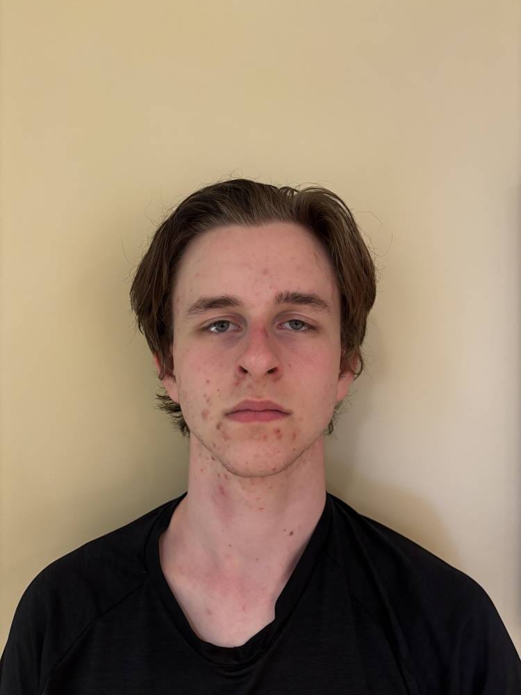 FRASER Rhys