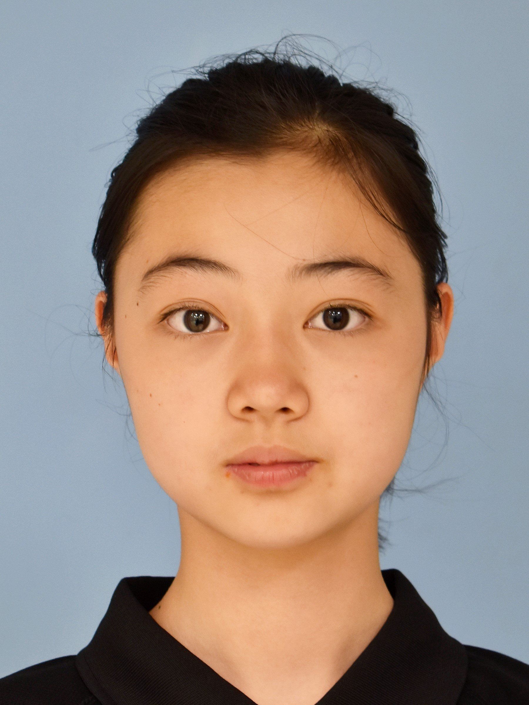 Ting Xuan HU