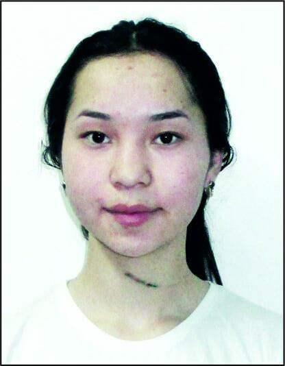 Zhadyra NAKHIPBEK