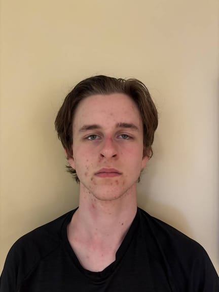Rhys FRASER