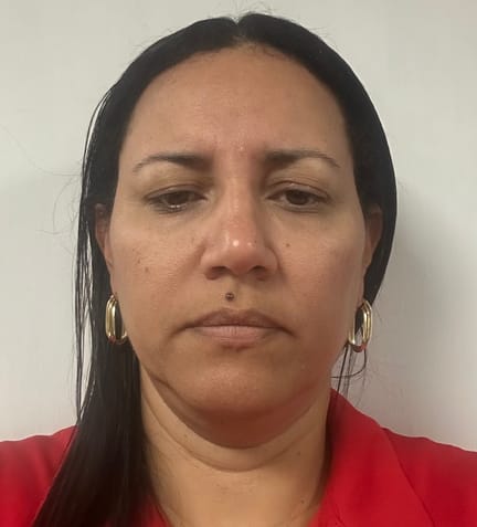 Yamara K ESCALANTE